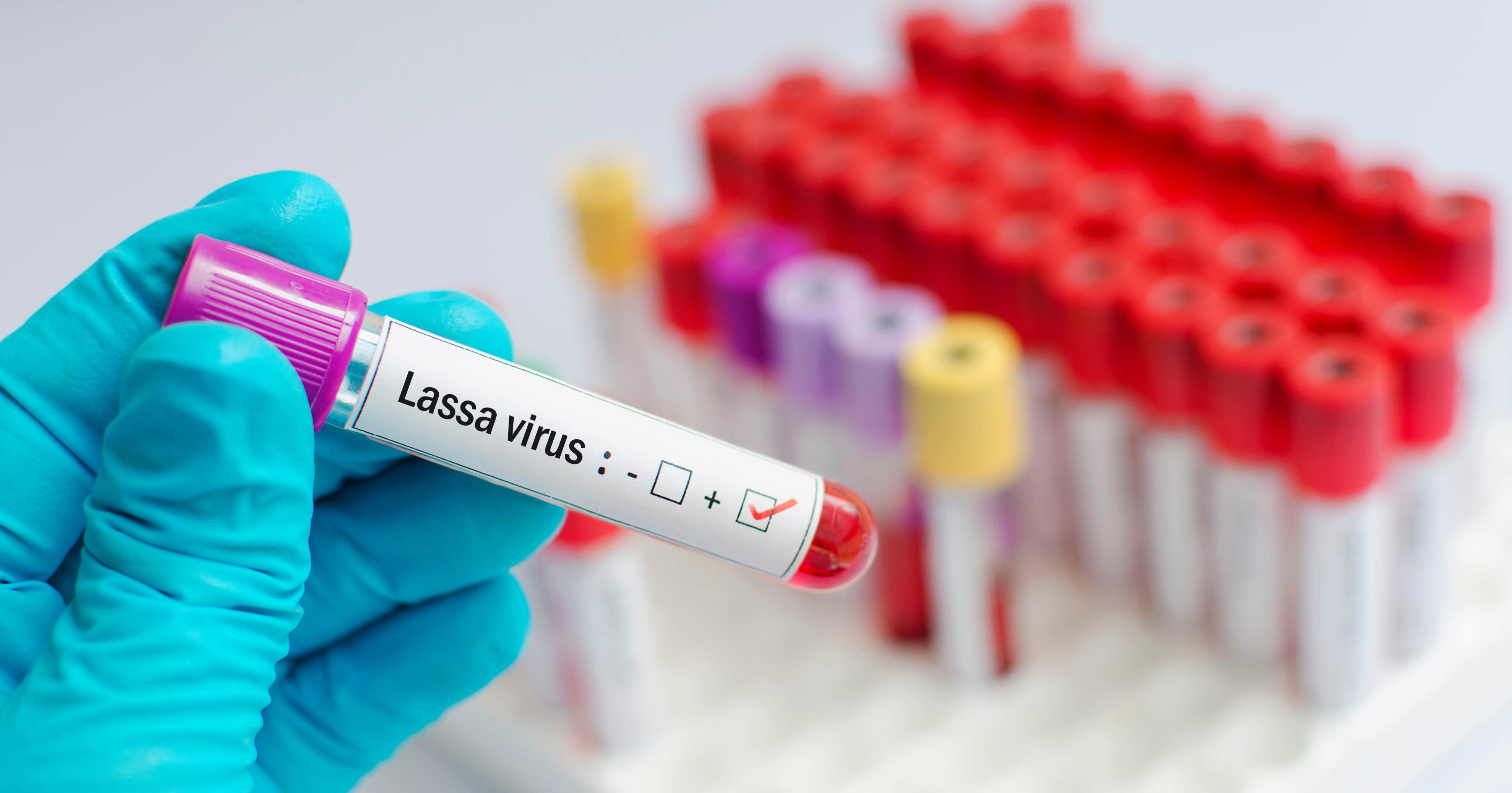 Virus Lassa Virus Lassa