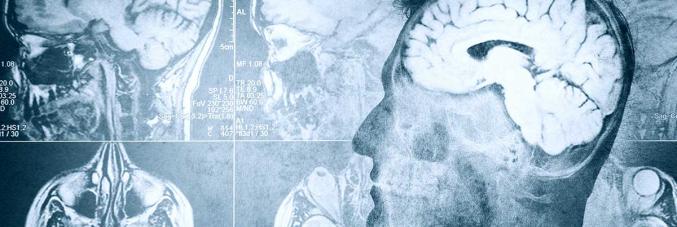 immagine medica dei cervelli