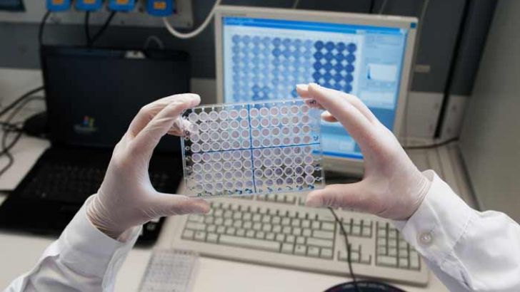 laboratorio per l'immunologia